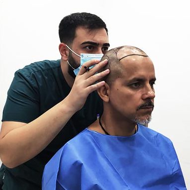 This image shows a doctor in a surgical setting carefully marking the recipient area on a patient's scalp to plan the graft placement for a hair transplant procedure