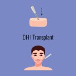 Vector illustration of beard hair transplant using the DHI method. Close-up of the transplantation process with a smaller illustration of a human head