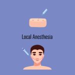 Illustration showing local anesthesia being applied, with a syringe injecting into a block of tissue above and a syringe applying anesthesia to the face of a man with dotted lines marking the beard transplant area