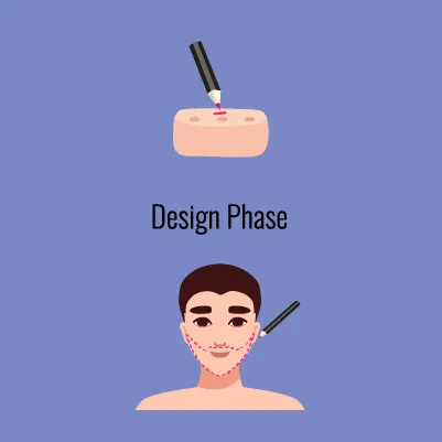 Illustration showing the design phase of a beard transplant procedure, with a pen marking a block of tissue above and a pen outlining dotted lines on a man's face to plan the beard area