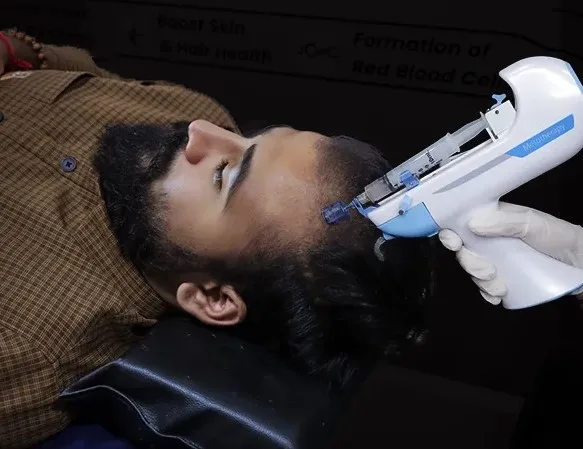 Nurse performing mesotherapy treatment on a patient by injecting active ingredients into the scalp using a fine needle