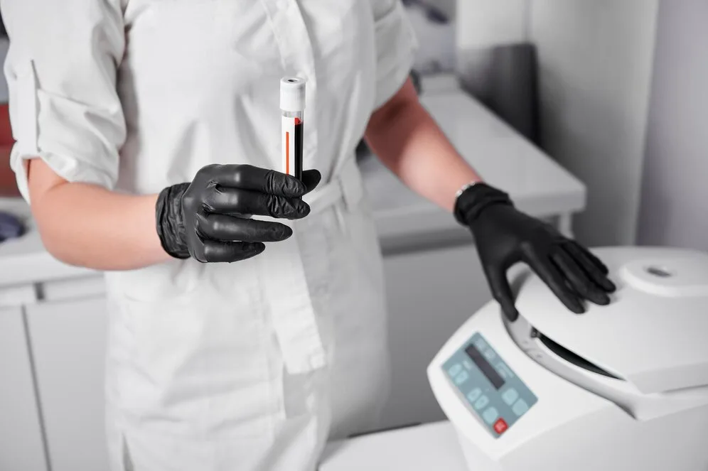 PRP therapy preparation: nurse loading blood sample into medical centrifuge for platelet-rich plasma hair restoration treatment
